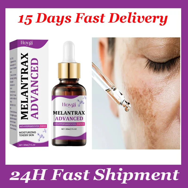 Dark Spots Remover Whitening Serum Face Freckle Melanin Correcting Anti Pigmentation Brighten Beauty Korean Day Night Skin Care