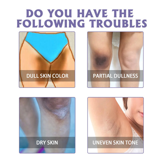 Body Whitening Stick Lighten Armpit Private Parts Melanin Brighten Dark Spot Remover Improve Body Dull Knee Butt Bleaching Cream