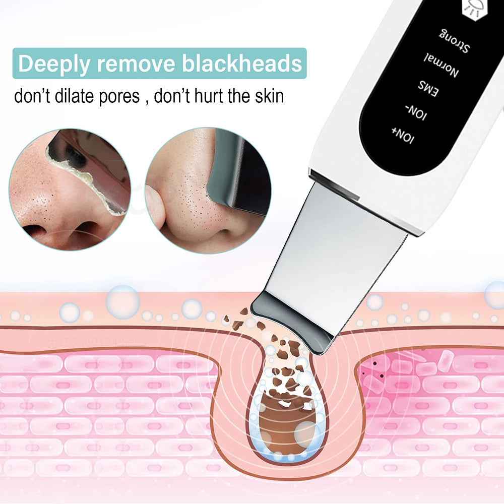 Ultrasonic Skin Scrubber Facial Peeling Face Scrubber Blackhead Remover Ance Pore Deep Facial Cleaning Spatula Facial Cleanser