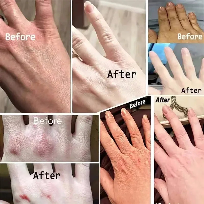 Whitening Cream Private Parts Underarm Bleaching Serum Whiten Butt Knee Brighten Inner Thigh Intimate Parts Dark Remove Melanin