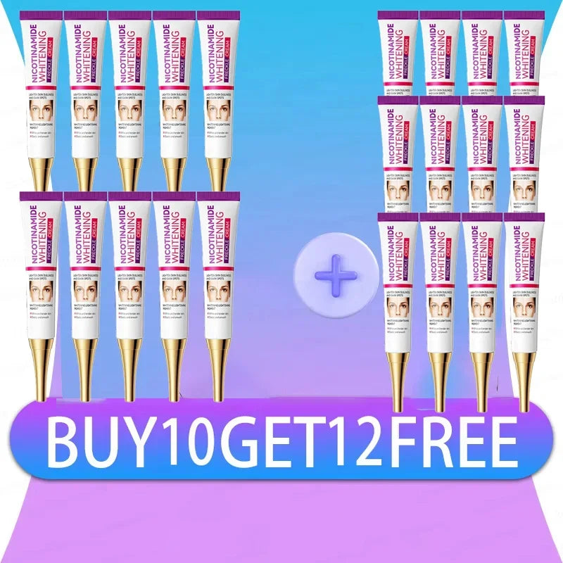 Mild Niacinamide Lightening Melasma Cream Effectively Fade Melanin Bleaching Cream Remove Dark Pigment Moisturizing Skin Care