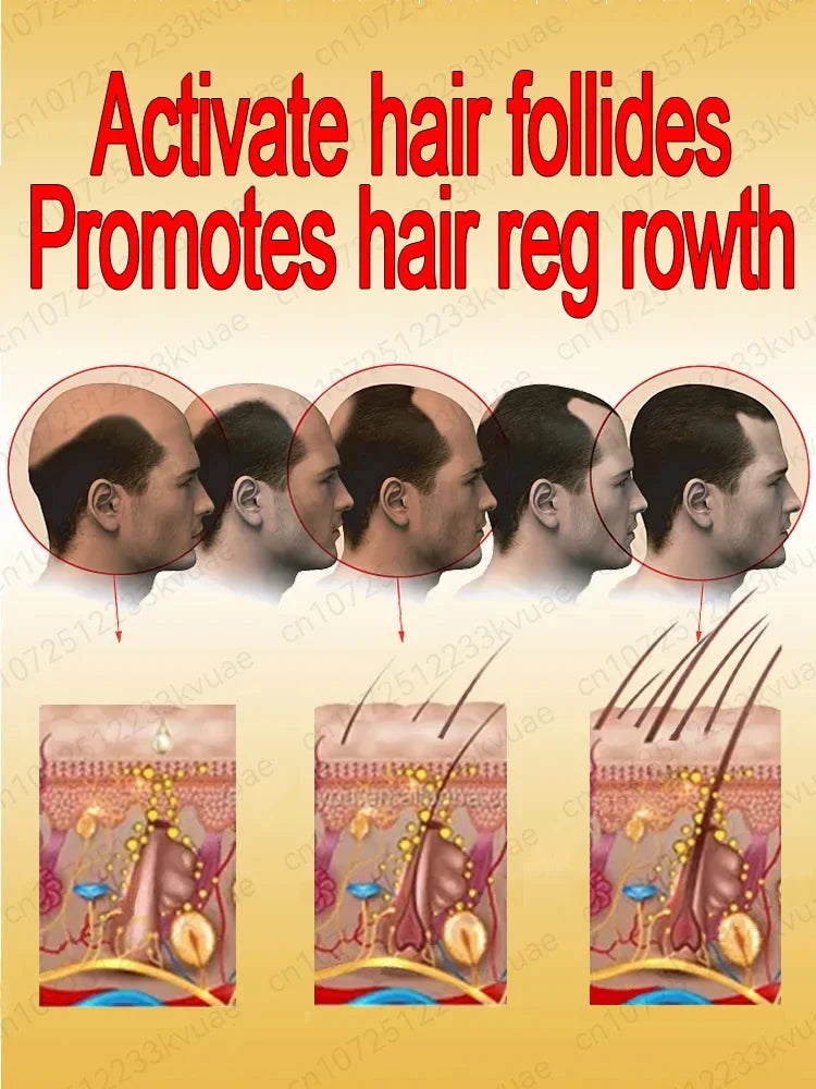 No longer worry about baldness, you will grow thick hair by using this product