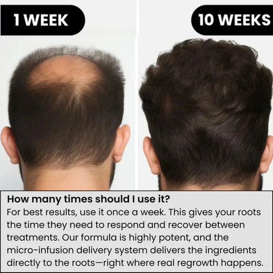 Hair Serum Gentle nourishes the scalp and cares for the softening hair care Daily Care Scalp Serum