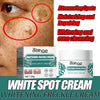 eelhoe Niacinamide Melasma Brightening Cream Reduce Melanin Brighten Cream Lighten Dark Skin Chloasma Serum Fade Fine Face Lines