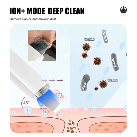 Ultrasonic Skin Scrubber Facial Lifting Massager Spatula Facial Exfoliator Scraper and Blackhead Remover Facial Deep Cleansing