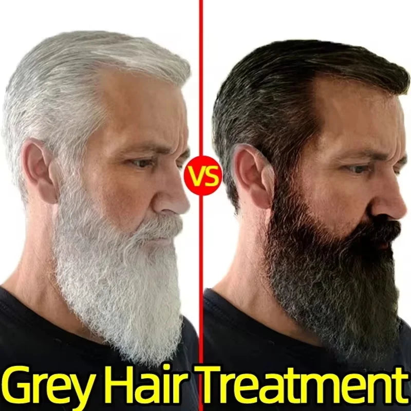 Herbal Anti-grey Hair Treatment Serum Cream White To Black Permanent Repair Natural Color Nourish Scalp Hair Care Products