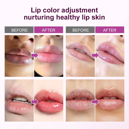 Remove Dark Lip Balm Fast Lightening Pink Lip Exfoliating Fade Lip Line Dead Skin Moisturizer Korean Care Products Beauty Health