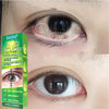 Sumifun 20g Chinese Herbal Medicine Eye Care Cream Brighter Looking Eyes Relieve Eye Fatigue Problems Eyes Red Blood Clear