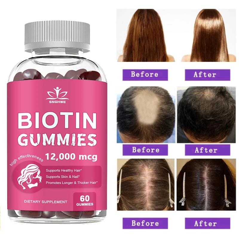 Collagen Gummies Biotin Gummies for Skin Care Health Nails Hair Growth Vitamins Collagen Protein Supplement