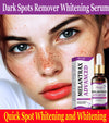 Dark Spots Remover Whitening Serum Face Freckle Melanin Correcting Anti Pigmentation Brighten Beauty Korean Day Night Skin Care