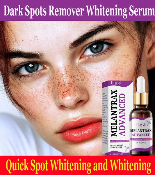 Dark Spots Remover Whitening Serum Face Freckle Melanin Correcting Anti Pigmentation Brighten Beauty Korean Day Night Skin Care