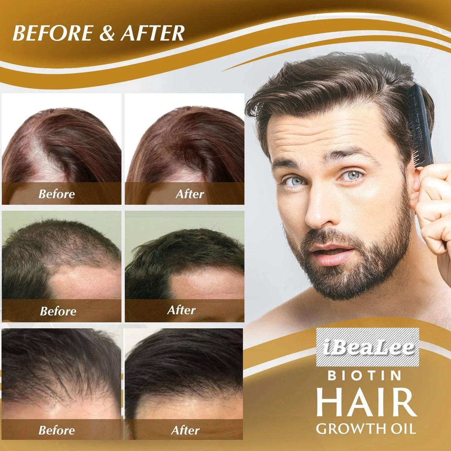 Biotin Hair Growth Serum Anti Hair Loss Spray Scalp Treatment Fast Growing Essential Oils For Men Women Hair Care Products 2024