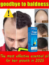 If you are suffering from hair loss and baldness, don’t miss this product.