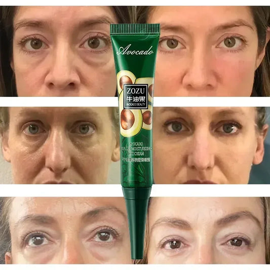 Instant Remove Wrinkles Eye Cream Fade Eye Fine Line Anti Aging Dark Circles Bags Puffiness Tighten Under Eyes Skin Care 2024
