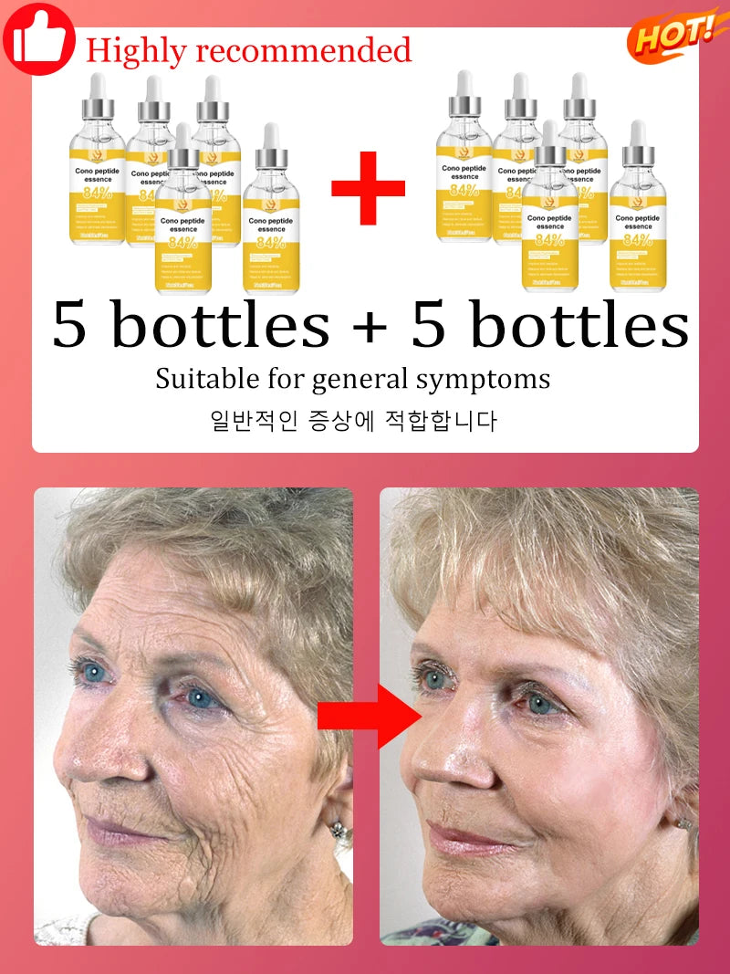 NO Wrinkle, 20 years younger.full body face.More discounts on packages