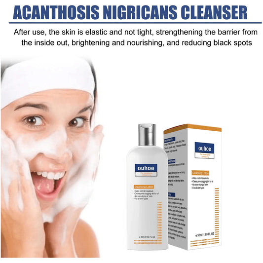 Whitening Facial Cleanser Remove Melasma Dark Spot Fade Melanin Pigmentation Anti Acne Moisturize Brighten Smooth Face Skin Care