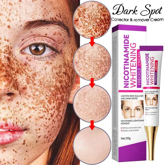 Mild Niacinamide Lightening Melasma Cream Effectively Fade Melanin Bleaching Cream Remove Dark Pigment Moisturizing Skin Care