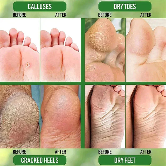 Herbal Anti Crack Foot Cream Heel Cracking Repair Products Exfoliation Dead Skin Removal Softening Moisturize Smooth Skin Care