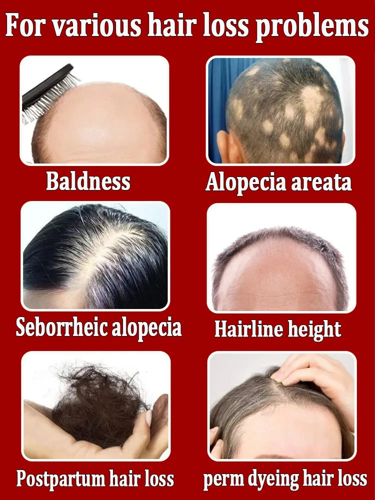 Goodbye baldness. Hair growth essential oils usually contain some special ingredients that can provide sufficient nutrition to h