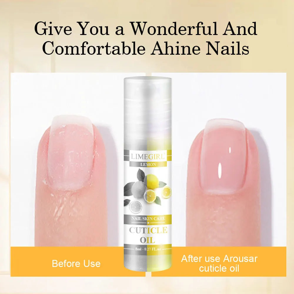 LIMEGIRL 8ml Nail Nutritional Oil 6 Scents Nail Care Cuticle Repair Oil Hangnail Prevention Nourishing Skin Remedy Nail Polish