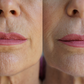 Ageless Lip & Line Filler