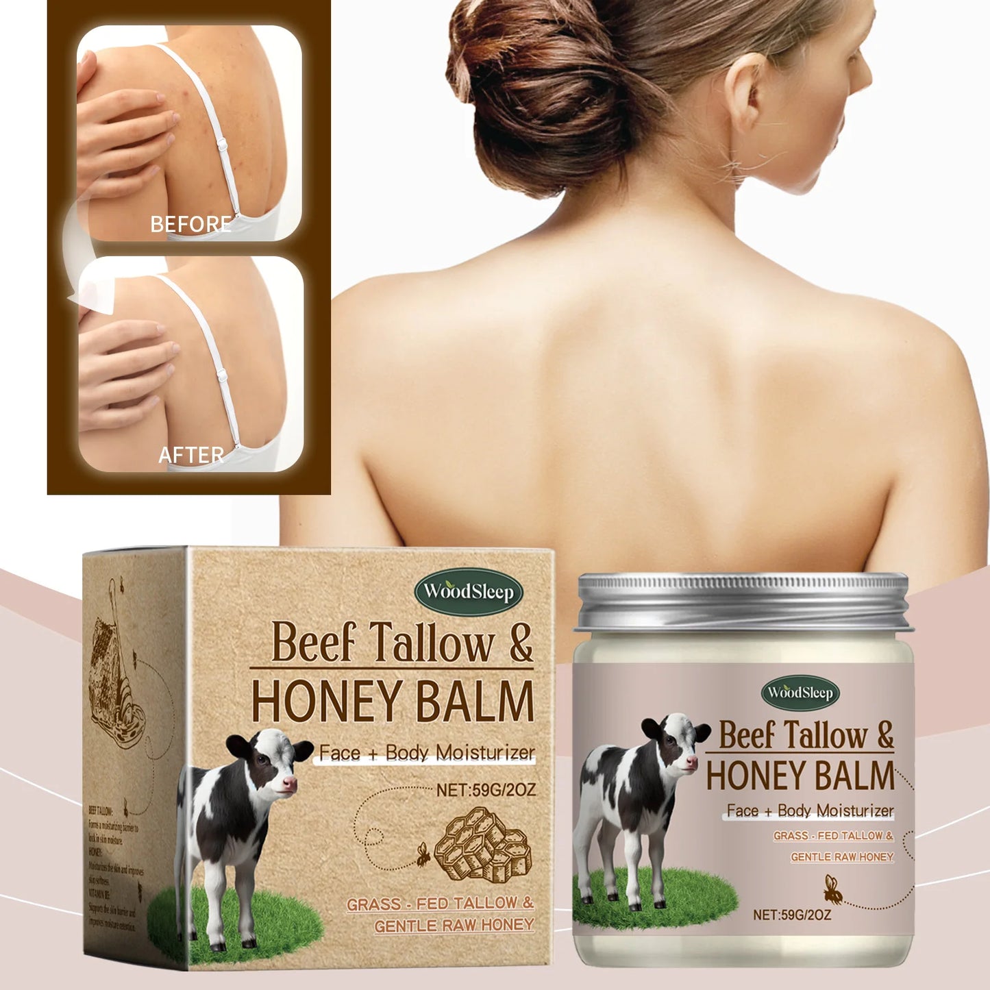 Body Moisturizer Removal Chicken Skin Cleaning Acne Spots Improving Elasticity Body Diminishing Dull Skin Gentle Smoothing Cream