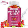 Natural Biotin Gummies - Supports Hair, Skin, Nails & Collagen, Dietary Supplement, Antioxidant - 100 Gummies