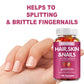 Natural Biotin Gummies - Supports Hair, Skin, Nails & Collagen, Dietary Supplement, Antioxidant - 100 Gummies