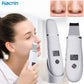 Blackhead Remover Electric Pore Face Cleaner Pimple Acne BlackHead Removal Black Dot Remove Ultrasonic Peeling Remover Blackhead