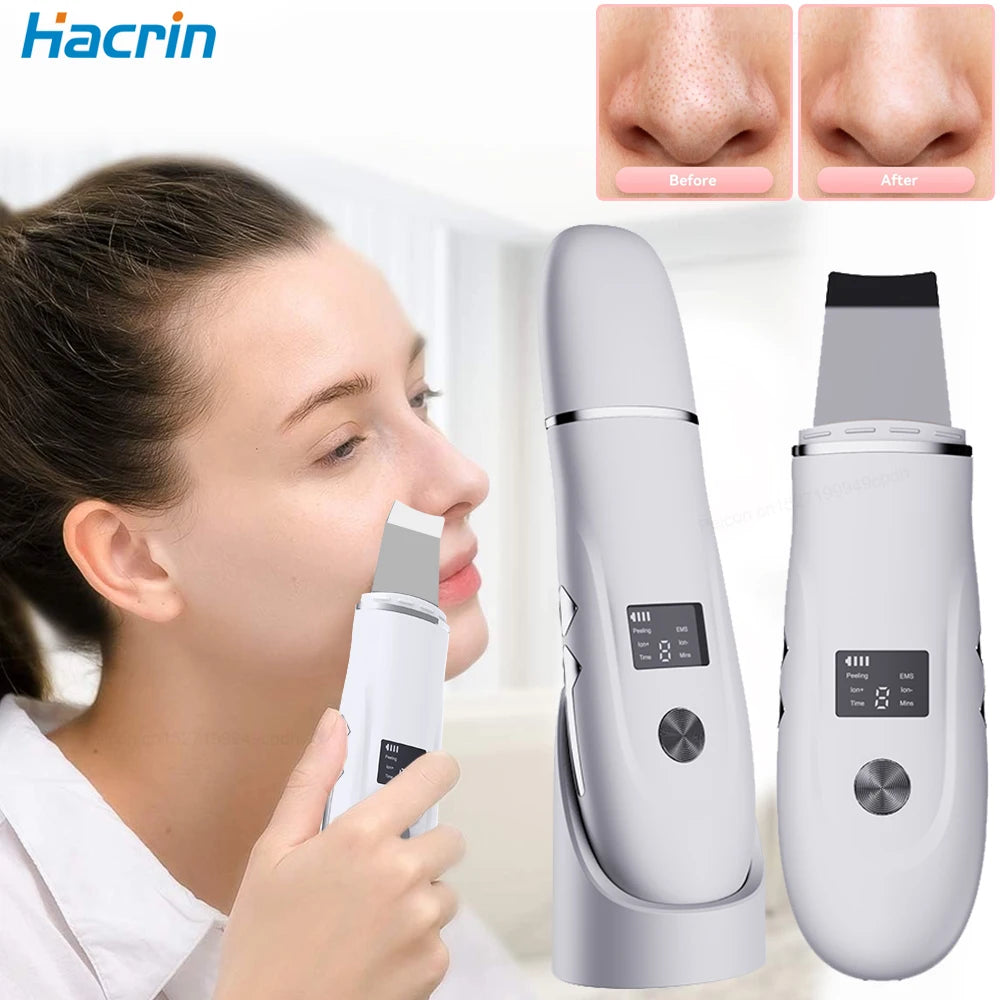 Blackhead Remover Electric Pore Face Cleaner Pimple Acne BlackHead Removal Black Dot Remove Ultrasonic Peeling Remover Blackhead