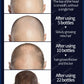 Grow cool hair secretly and surprise everyone. Say goodbye to baldness and hair loss now