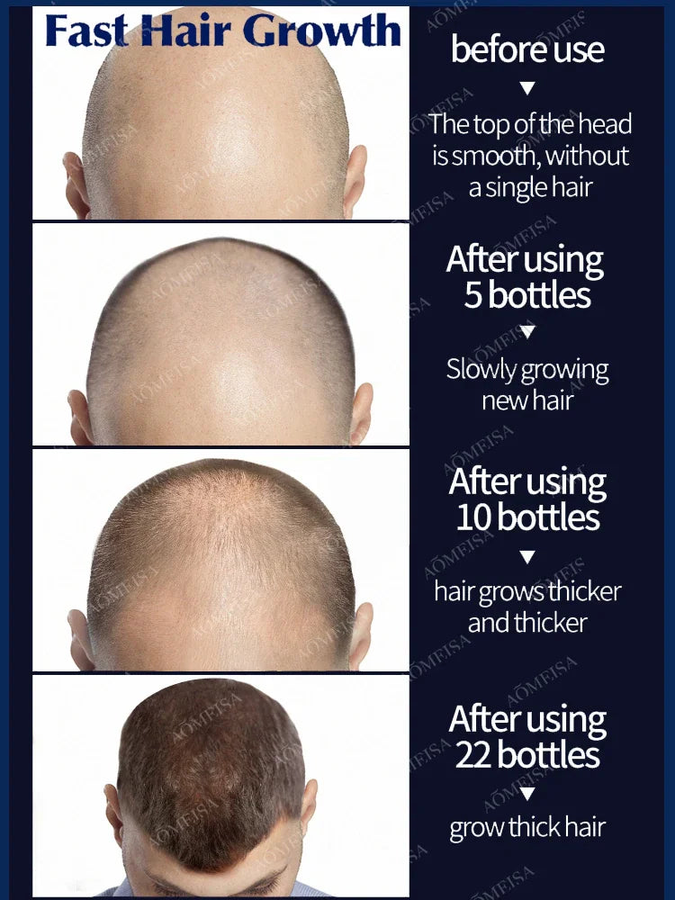 Grow cool hair secretly and surprise everyone. Say goodbye to baldness and hair loss now