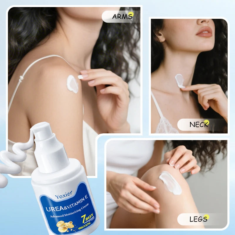 100g Chicken Skin Removal Cream Body Repair Keratosis Pilaris Rough Bumpy Pore Spots Dull Skin Care Whitening Moisturizing