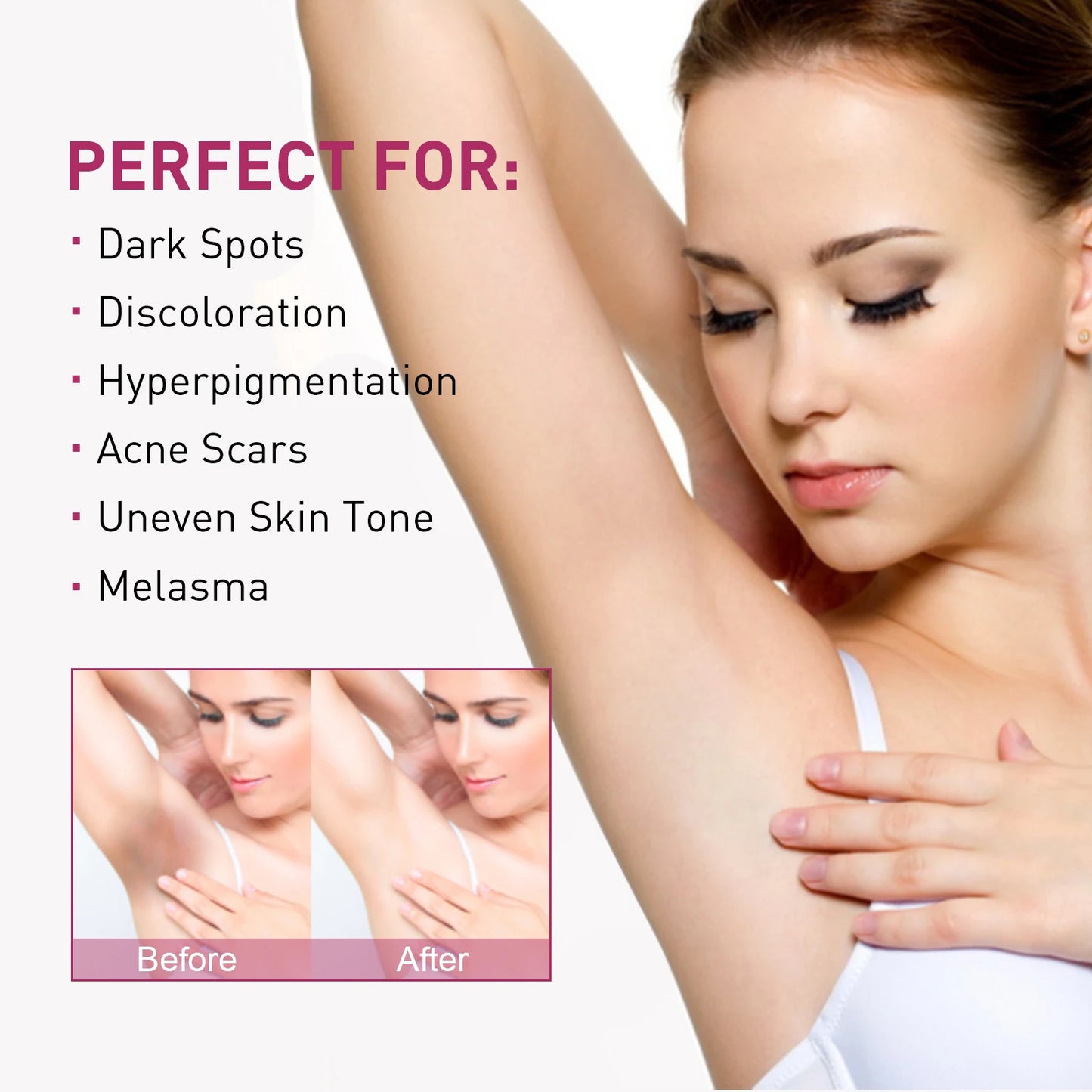 Whitening Cream For Dark Skin Underarm Armpit Thigh Inner Joint Lightening Sensitive Area Body Care Moisturizing Brighten Lotion