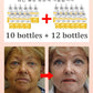 NO Wrinkle, 20 years younger.full body face.More discounts on packages