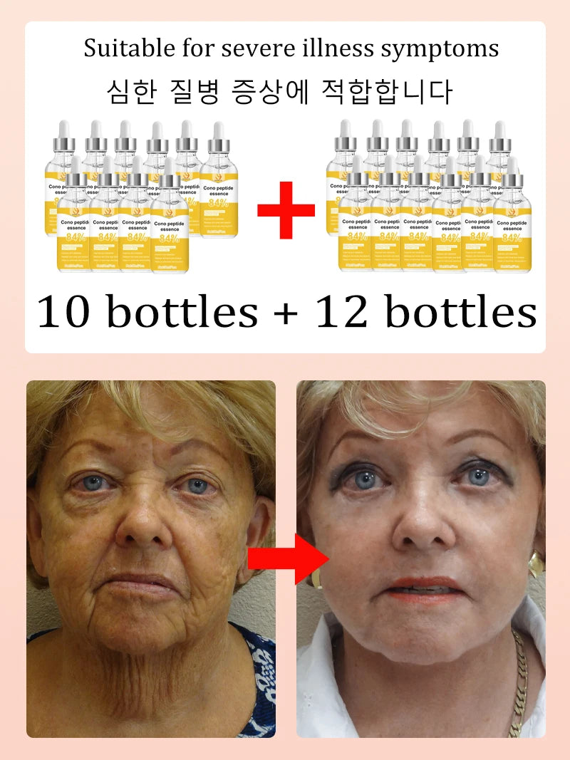 NO Wrinkle, 20 years younger.full body face.More discounts on packages