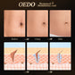 Rose Removes Stretch Mark Cream To Remove Postpartum Obesity Pregnant Women Repair Anti-Aging Anti-Winkles Firming Body Cream