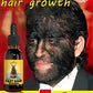 Grow cool hair secretly and surprise everyone. Say goodbye to baldness and hair loss now