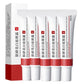 1/3/5pcs Whitening Freckle Cream Niacinamide Remove Dark Spot Cream Anti Freckle and Aging Cream Fade Pigmentation Melasma Skin