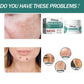 eelhoe Niacinamide Melasma Brightening Cream Reduce Melanin Brighten Cream Lighten Dark Skin Chloasma Serum Fade Fine Face Lines