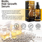 Biotin Hair Growth Serum Anti Hair Loss Spray Scalp Treatment Fast Growing Essential Oils For Men Women Hair Care Products 2024