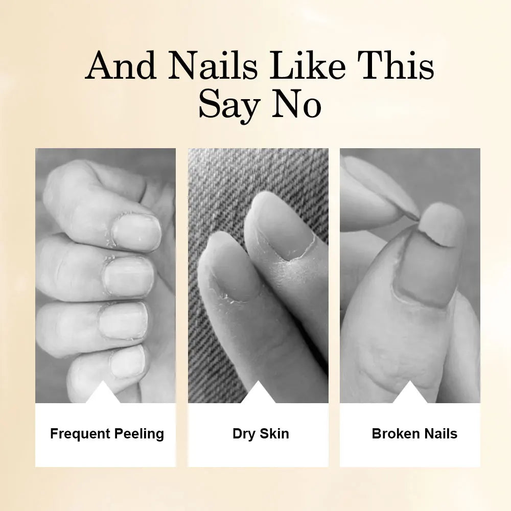 8ml Nail Nutrition Oil Pen 6 Smells Nail Treatment Cuticle Repair Oil Prevent Agnail Nail Polish Nourish Skin Remedy Manicure