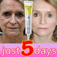 Retinol Anti-wrinkle Cream Collagen Anti-Aging Instant Removal Face Neck Wrinkle Efficient Moisturizing Firming Korean Skin Care