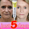 Retinol Anti-wrinkle Cream Collagen Anti-Aging Instant Removal Face Neck Wrinkle Efficient Moisturizing Firming Korean Skin Care