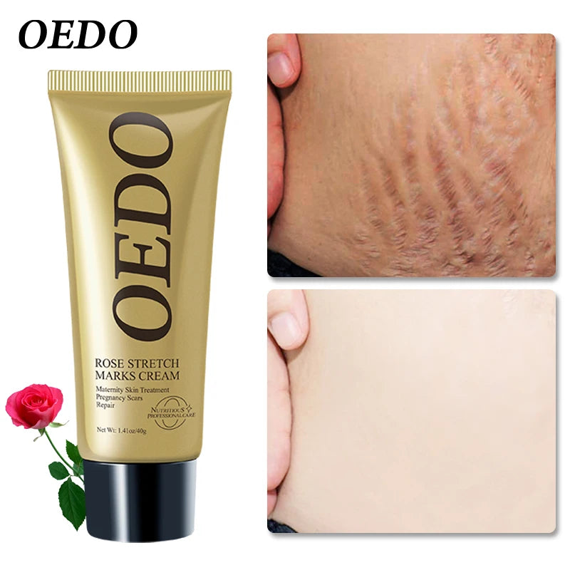 Rose Removes Stretch Mark Cream To Remove Postpartum Obesity Pregnant Women Repair Anti-Aging Anti-Winkles Firming Body Cream
