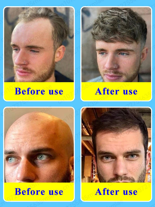 Grow cool hair secretly and surprise everyone. Say goodbye to baldness and hair loss now