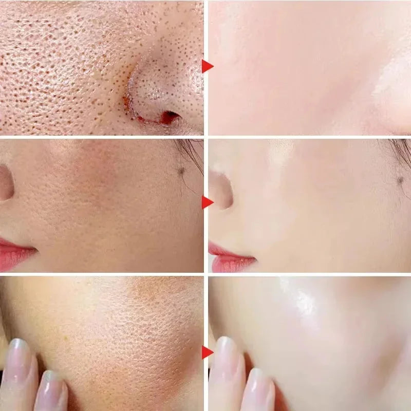 Lactic Acid Shrink Pores Serum Fast Large Pores Removal Firming Skin Essence Firming Smoothing Nourishing Repair Face Skin Care
