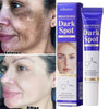Dark Spots Removal Cream Facial Whitening Freckle Acne Mark Pigmentation Removal Melanin Skin Correction Brighten Care Products