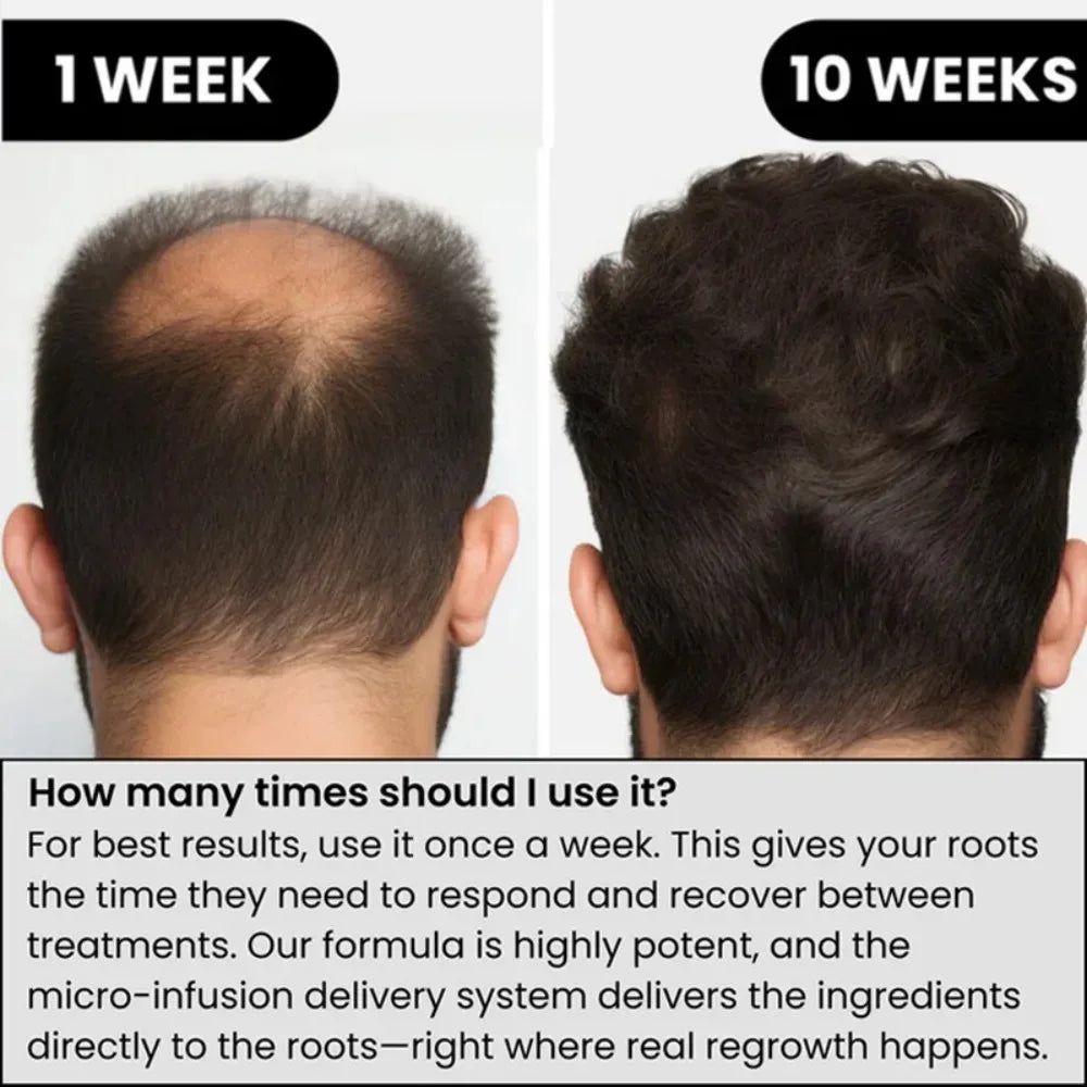 Hair Serum Gentle nourishes the scalp and cares for the softening hair care Daily Care Scalp Serum