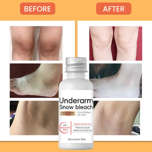 Whitening Cream Private Parts Underarm Bleaching Serum Whiten Butt Knee Brighten Inner Thigh Intimate Parts Dark Remove Melanin